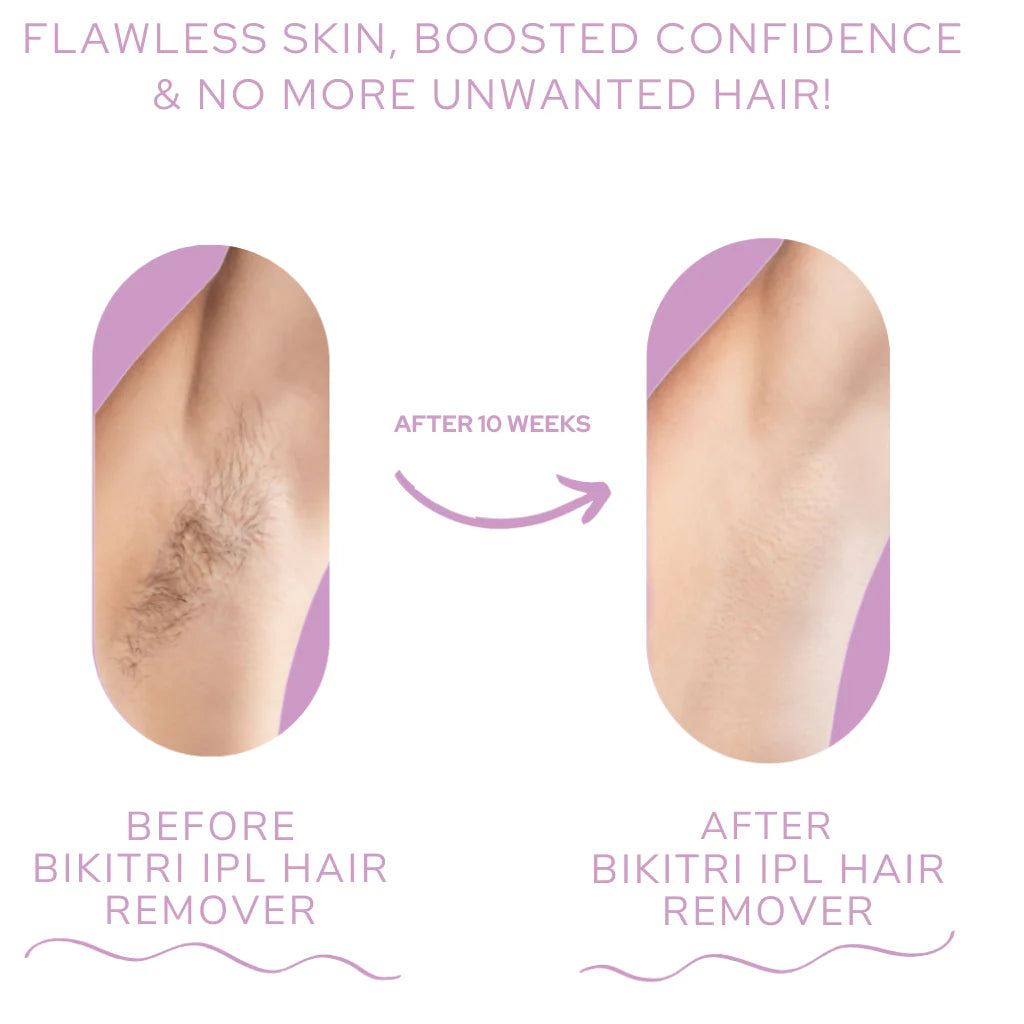 Professional IPL Laser Hair Removal Device