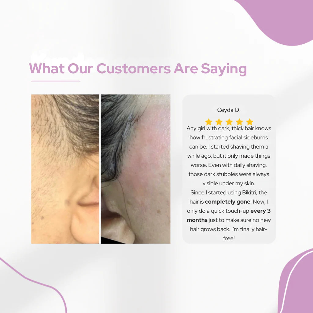 Professional IPL Laser Hair Removal Device