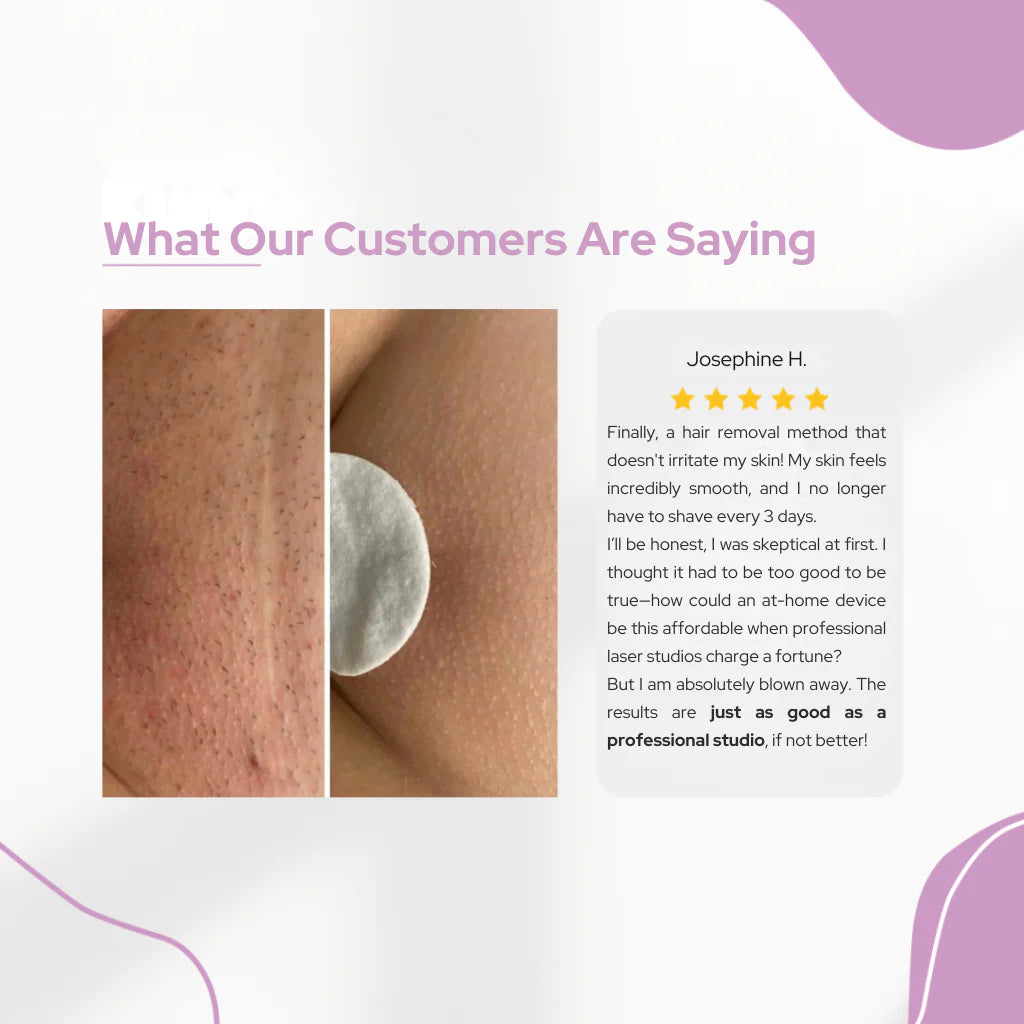 Professional IPL Laser Hair Removal Device