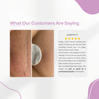 Professional IPL Laser Hair Removal Device